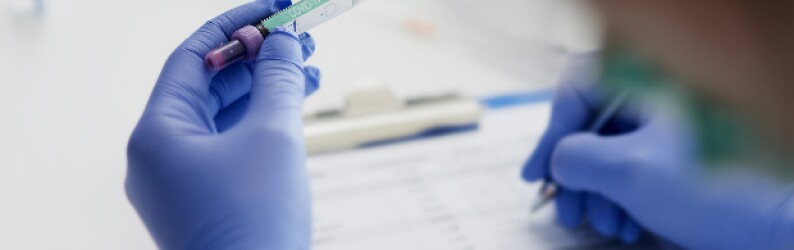blue-gloved-hands-holding-vial-writing-on-clipboard