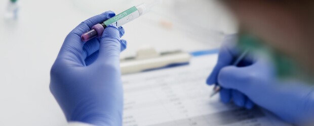 blue-gloved-hands-holding-vial-writing-on-clipboard