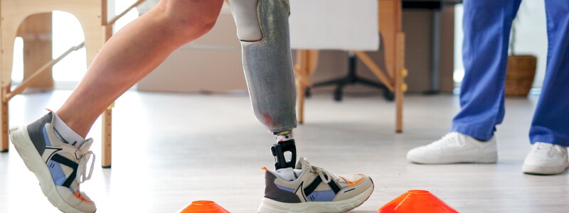 Physiotherapist works with a patient who uses a prosthetic leg
