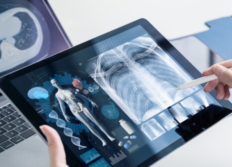 Health care laboratory results using big data, technology